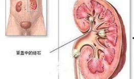 肾结石医院真实爆料视频,医院真实爆料视频曝光